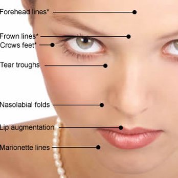 Botox: Your Personal Ticket To Ageless Elegance