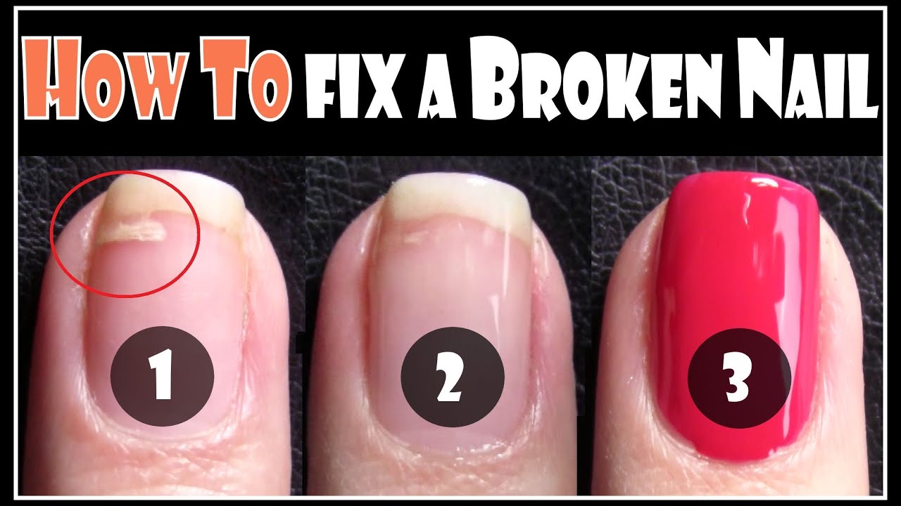 Breakups Breakages: Healing Broken Nails The Right Way
