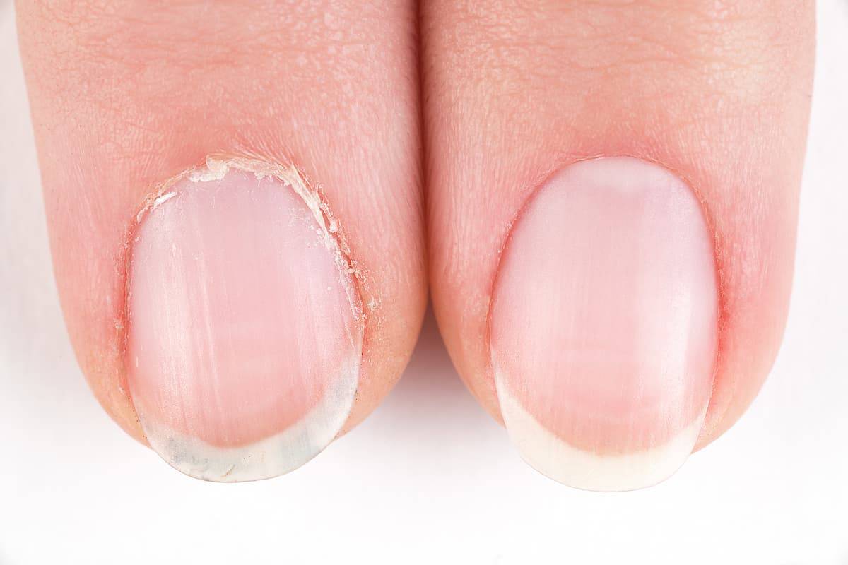 Cuticle Care 101: Maintaining Nail Health The Stylish.ae Way