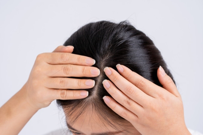 Dandruff Dilemmas: Trusted Remedies By Stylish.ae Specialists