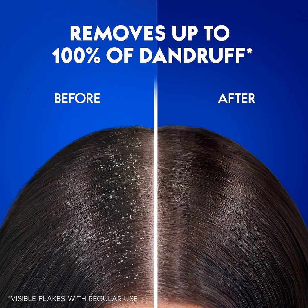 Head Shoulders Smooth Silky Anti-Dandruff Shampoo For Dry Frizzy Hair, 1000ml
