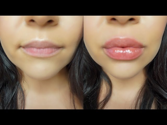 Lip Plumpers: Achieving Fuller Lips Without Injections