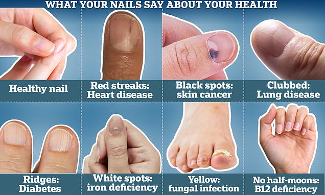 Nail Health 101: What Your Nails Say About Your Well-being