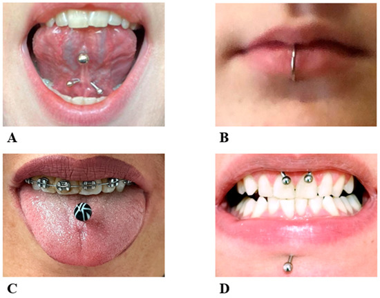 The Art Of Tongue Piercing: Risks, Benefits, And Stylish Choices