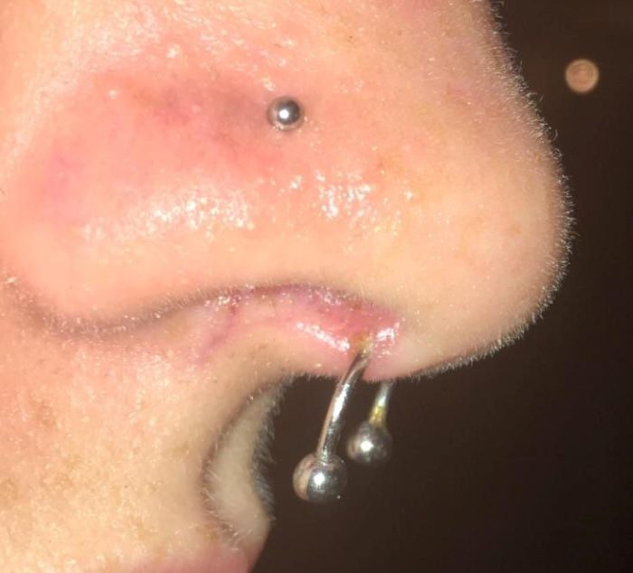 The Science Behind Piercing Rejection And Migration, Unveiled By Stylish.ae