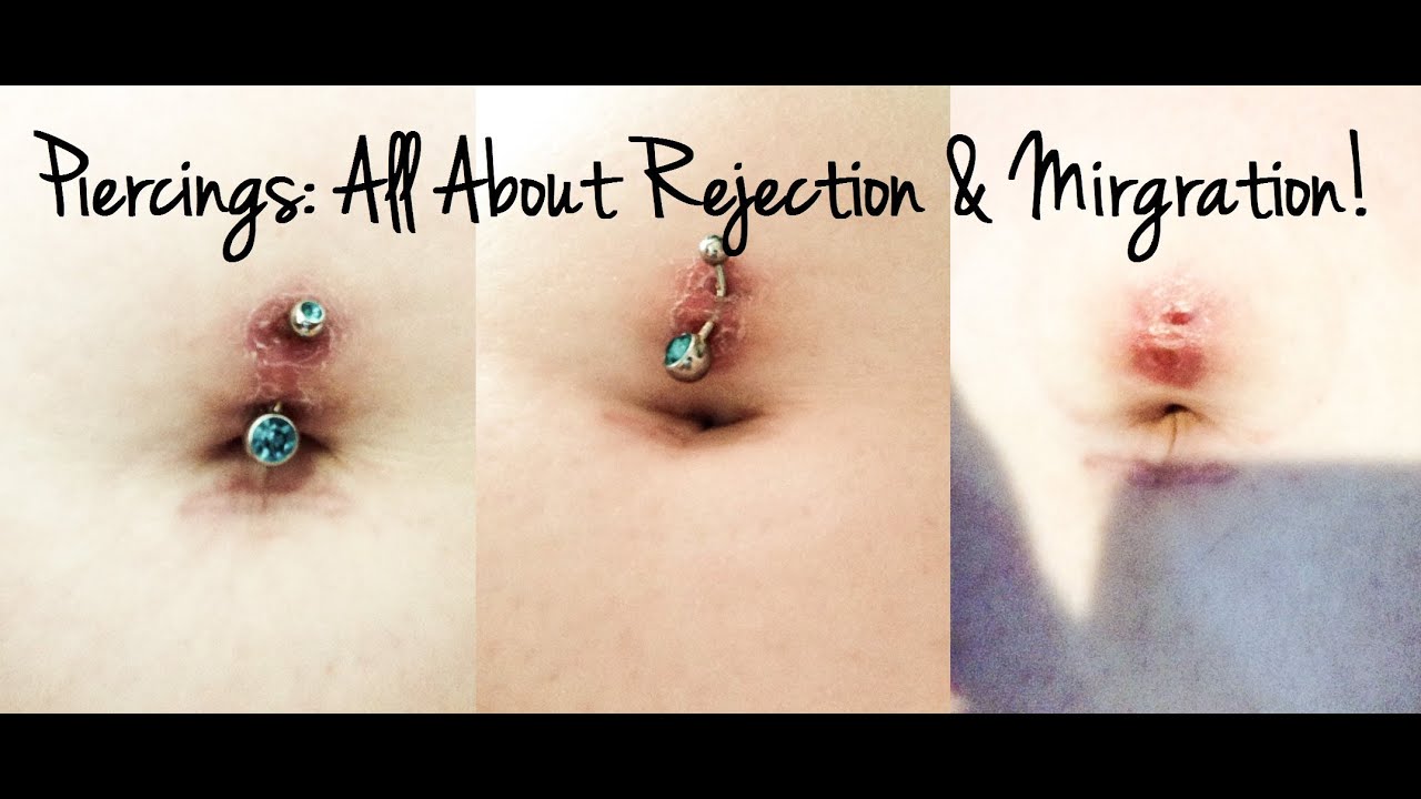The Science Behind Piercing Rejection And Migration, Unveiled By Stylish.ae