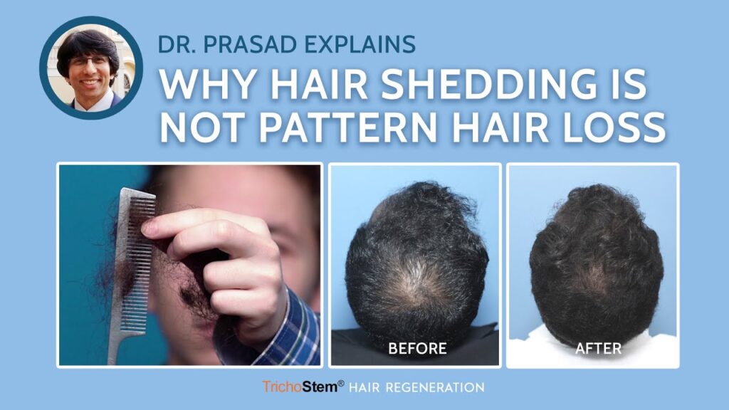 Understanding the Difference Between Hair Shedding and Hair Loss