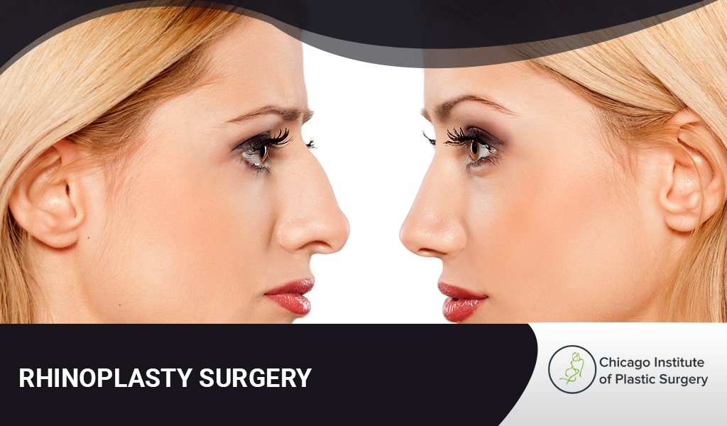 Unveiling The Art Of Rhinoplasty At Stylish.ae: Perfecting The Profile