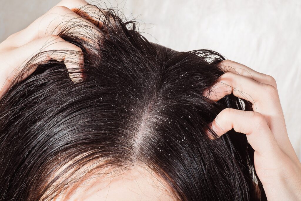 Scalp issues