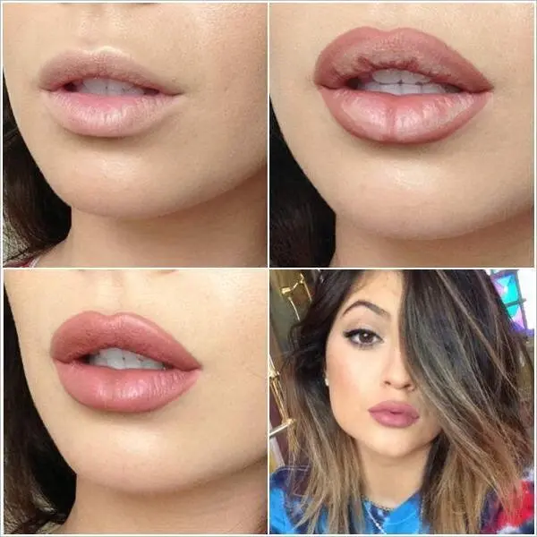 overline lips